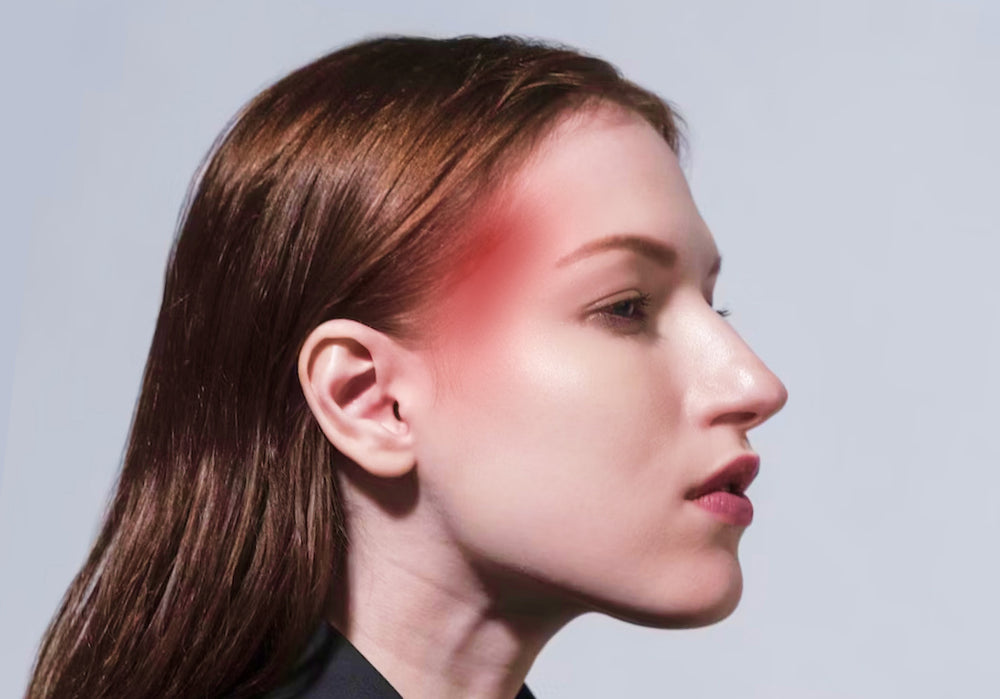 Migraine Botox