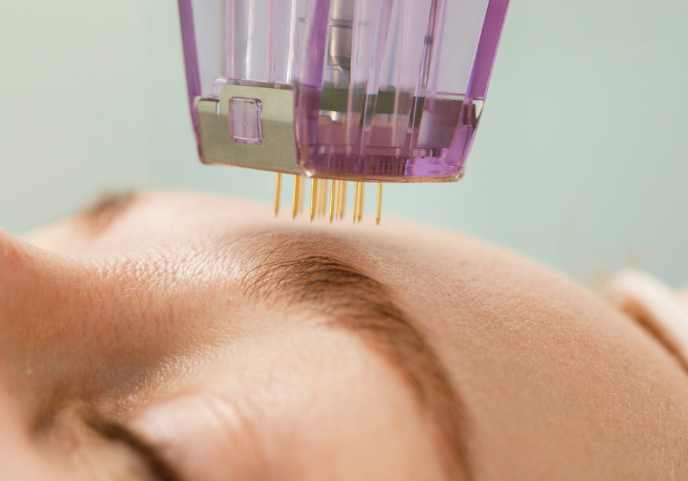 SkinPen® Microneedling