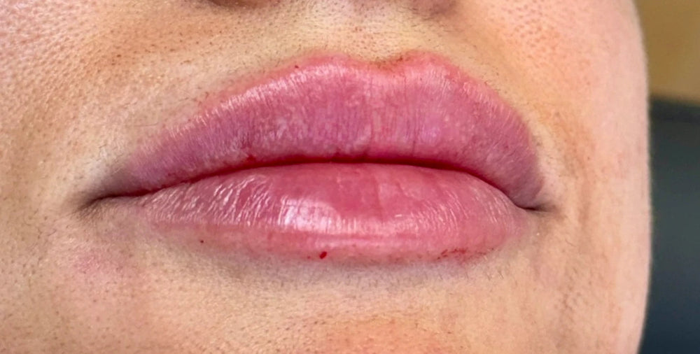 Lip Hydration