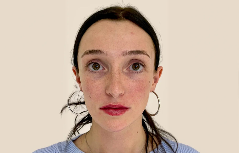 Full Facial Balancing - Front