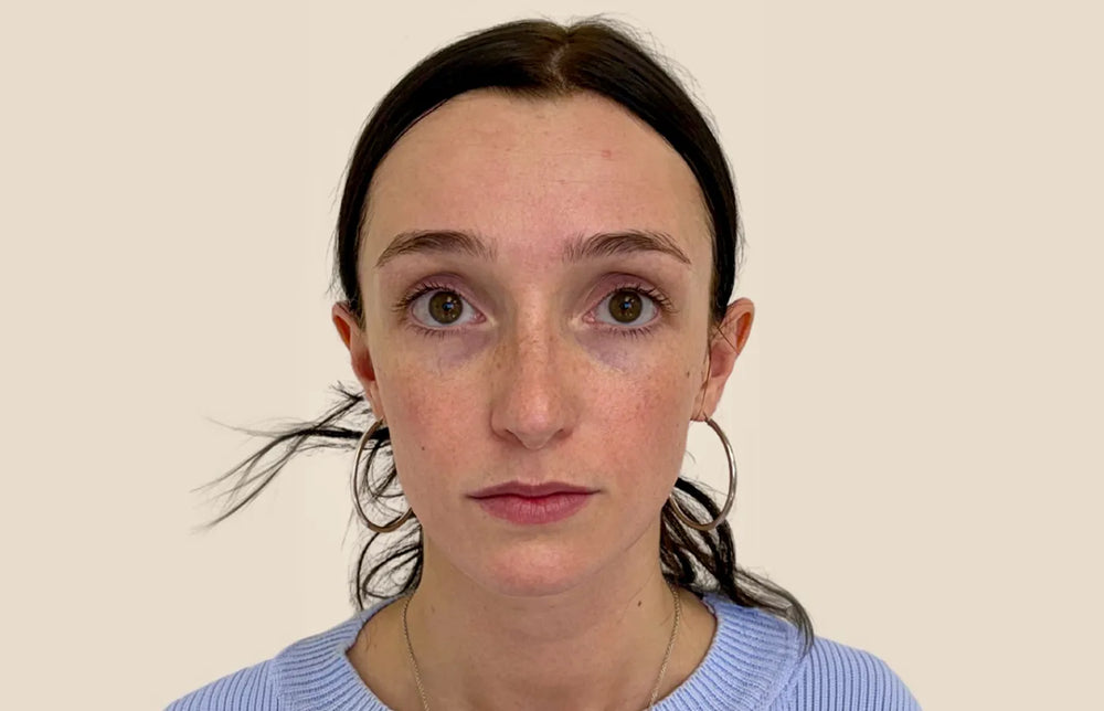 Full Facial Balancing - Front