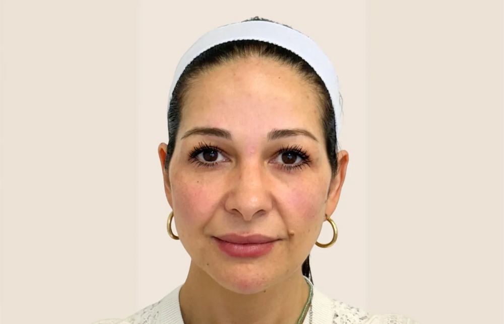 Full Facial Balancing - Front