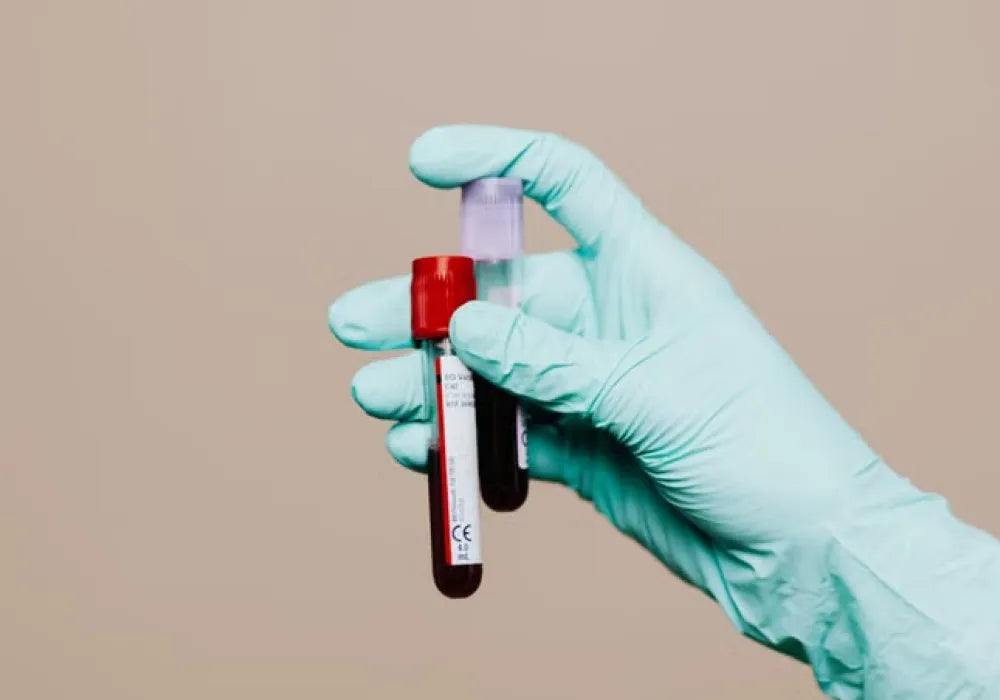 Lab Tests
