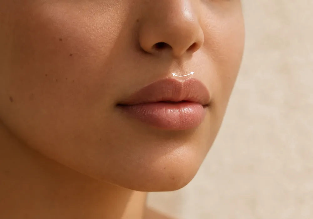 Lip Flip Botox